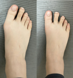 用户矫正前后对比